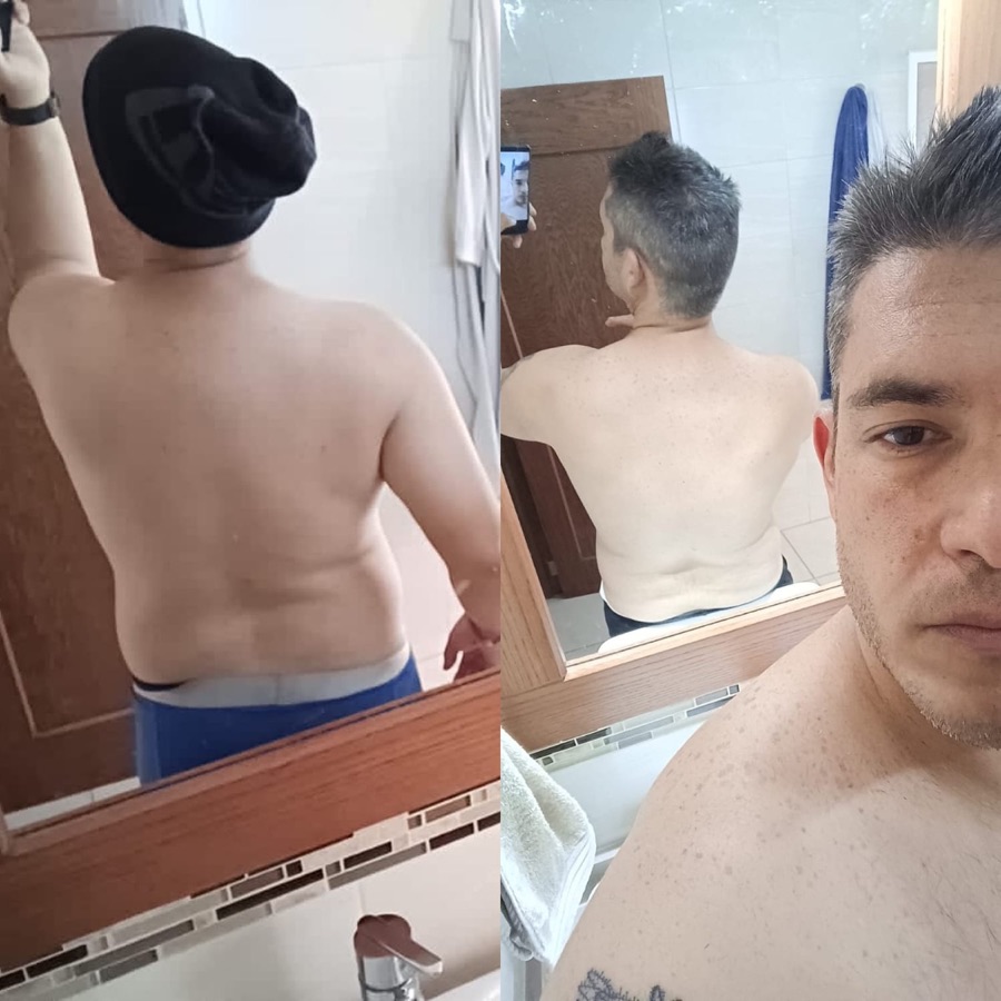 Alfonso: antes y después, de espalda
