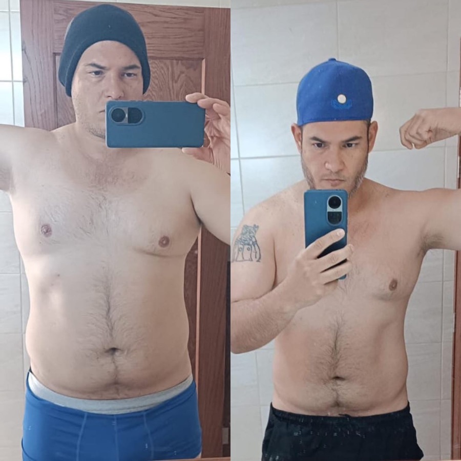 Alfonso: antes y después, de frente